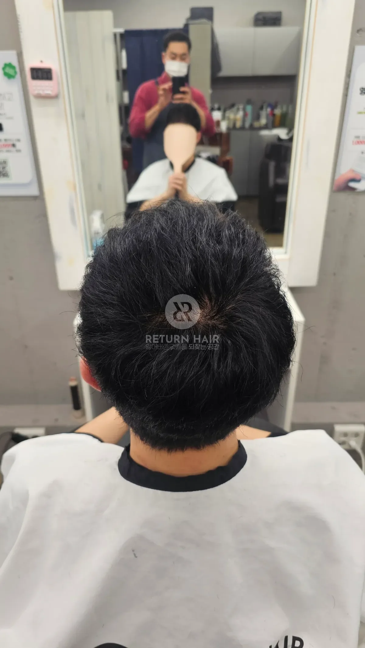 탈모 치트펌 파마 시술 후 결과 사진 2