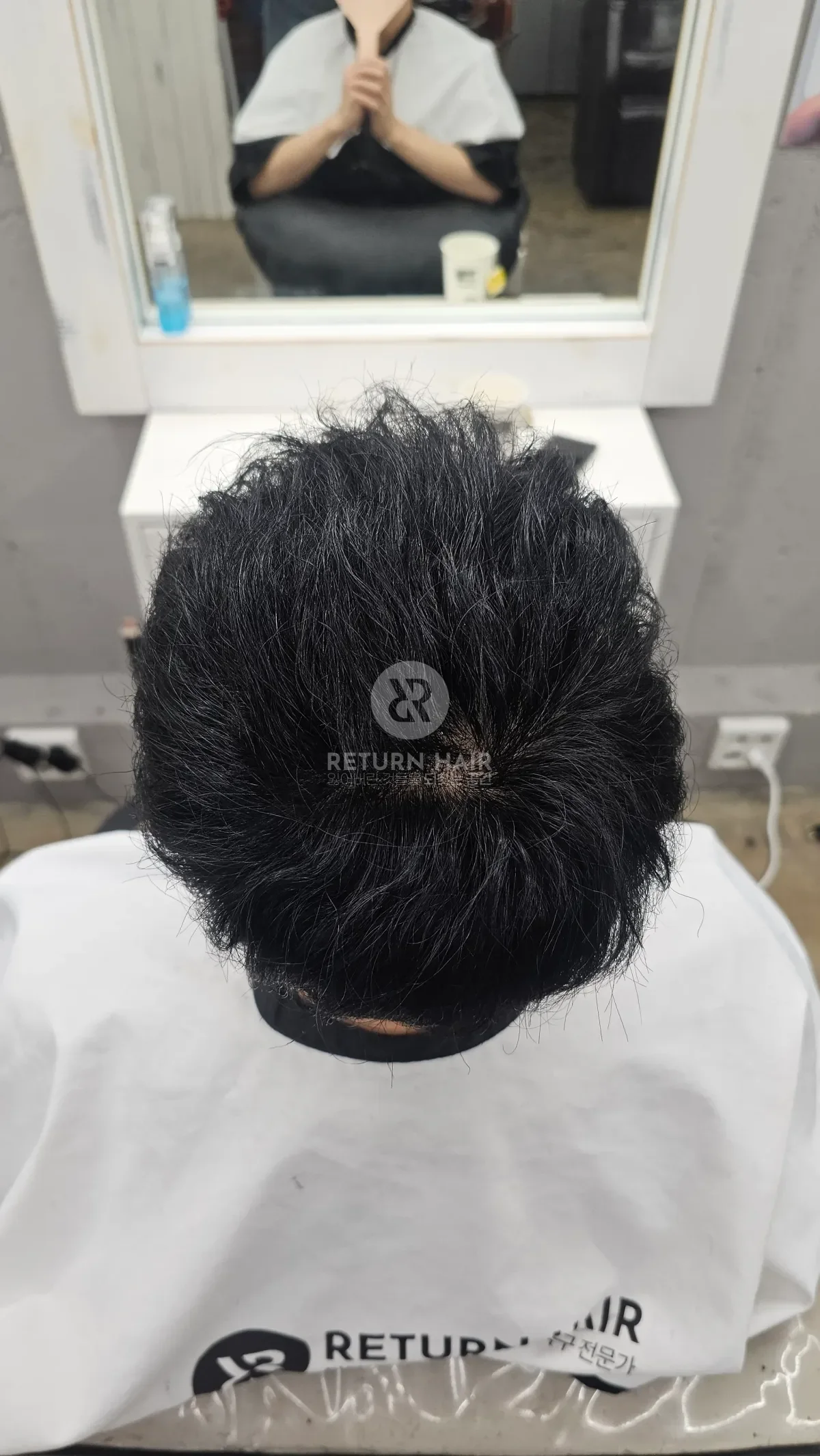 탈모 치트펌 파마 시술 후 결과 사진 3