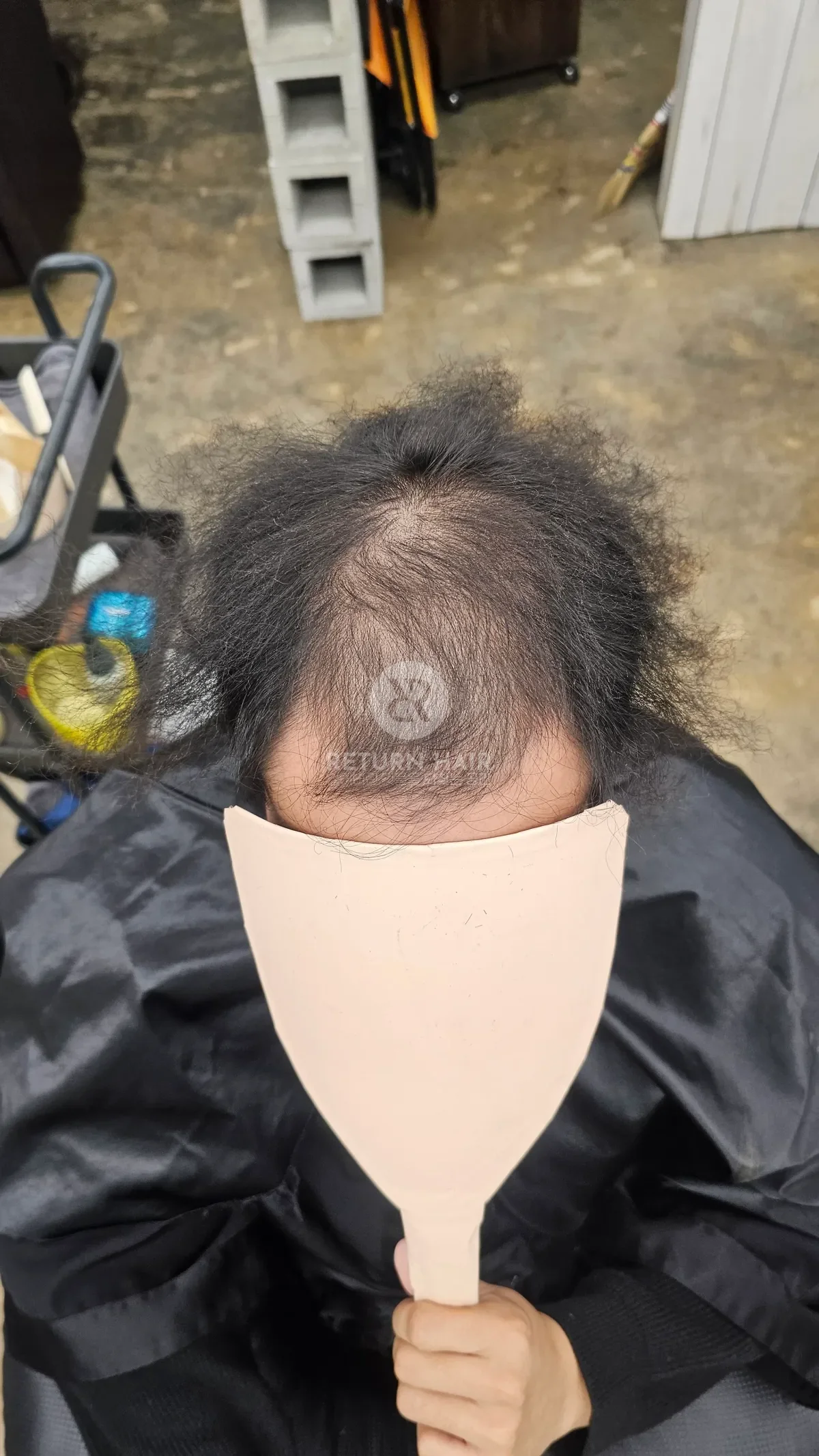 두피페인팅 (치트염색) 시술 전 사진
