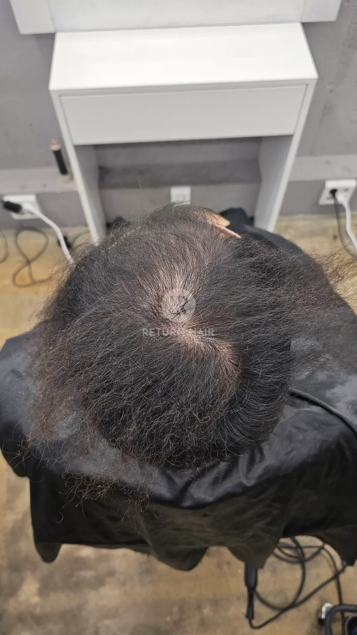 두피페인팅 (치트염색) 시술 전 사진 2