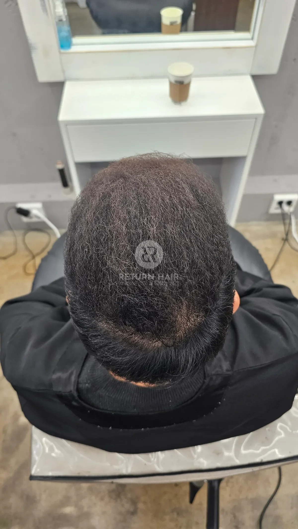 두피페인팅 (치트염색) 시술 후 결과 사진