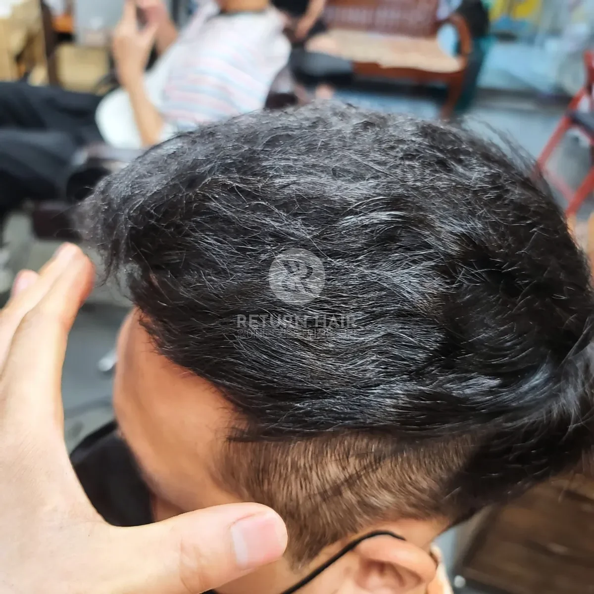 탈모 치트펌 파마 시술 후 결과 사진 4