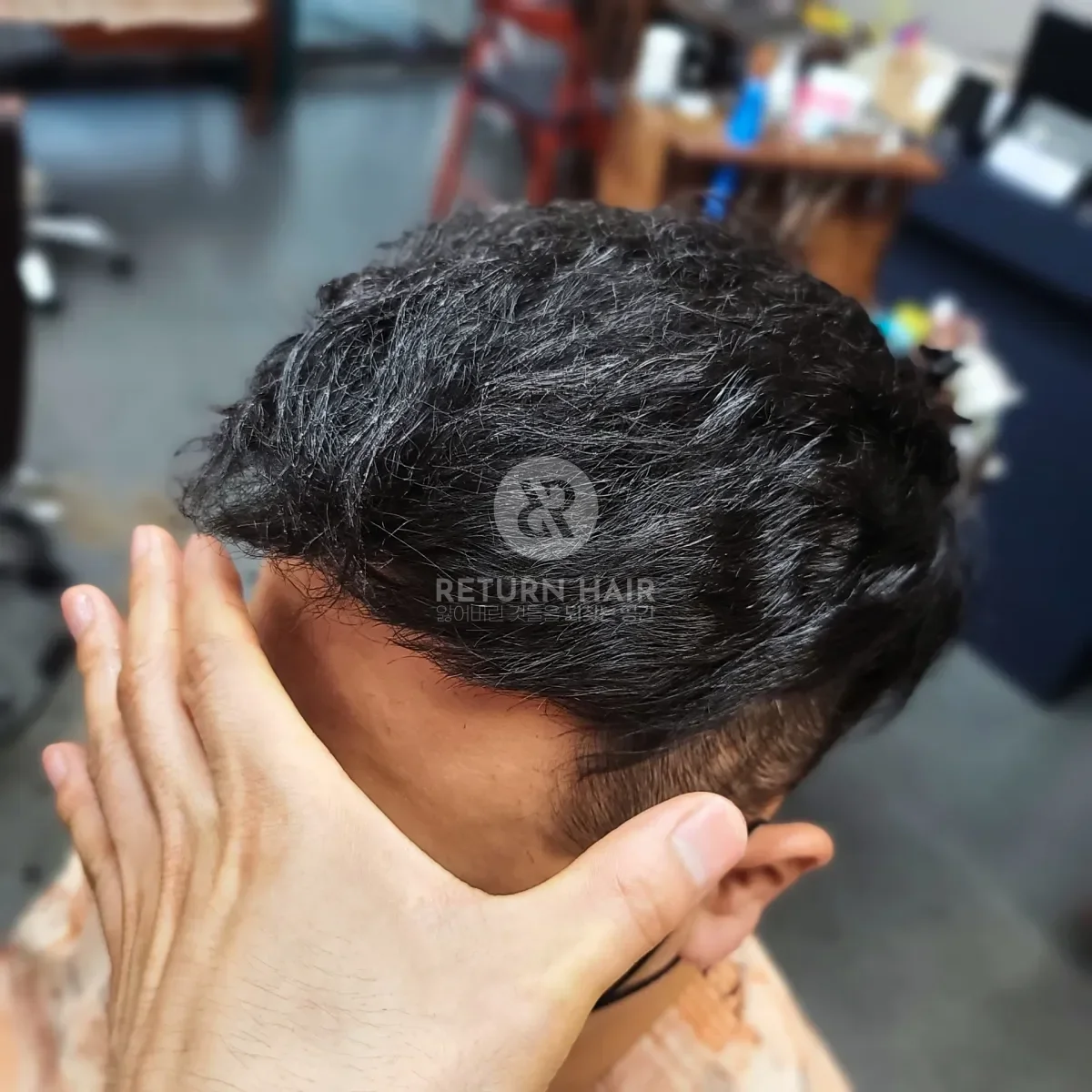 탈모 치트펌 파마 시술 후 결과 사진 5