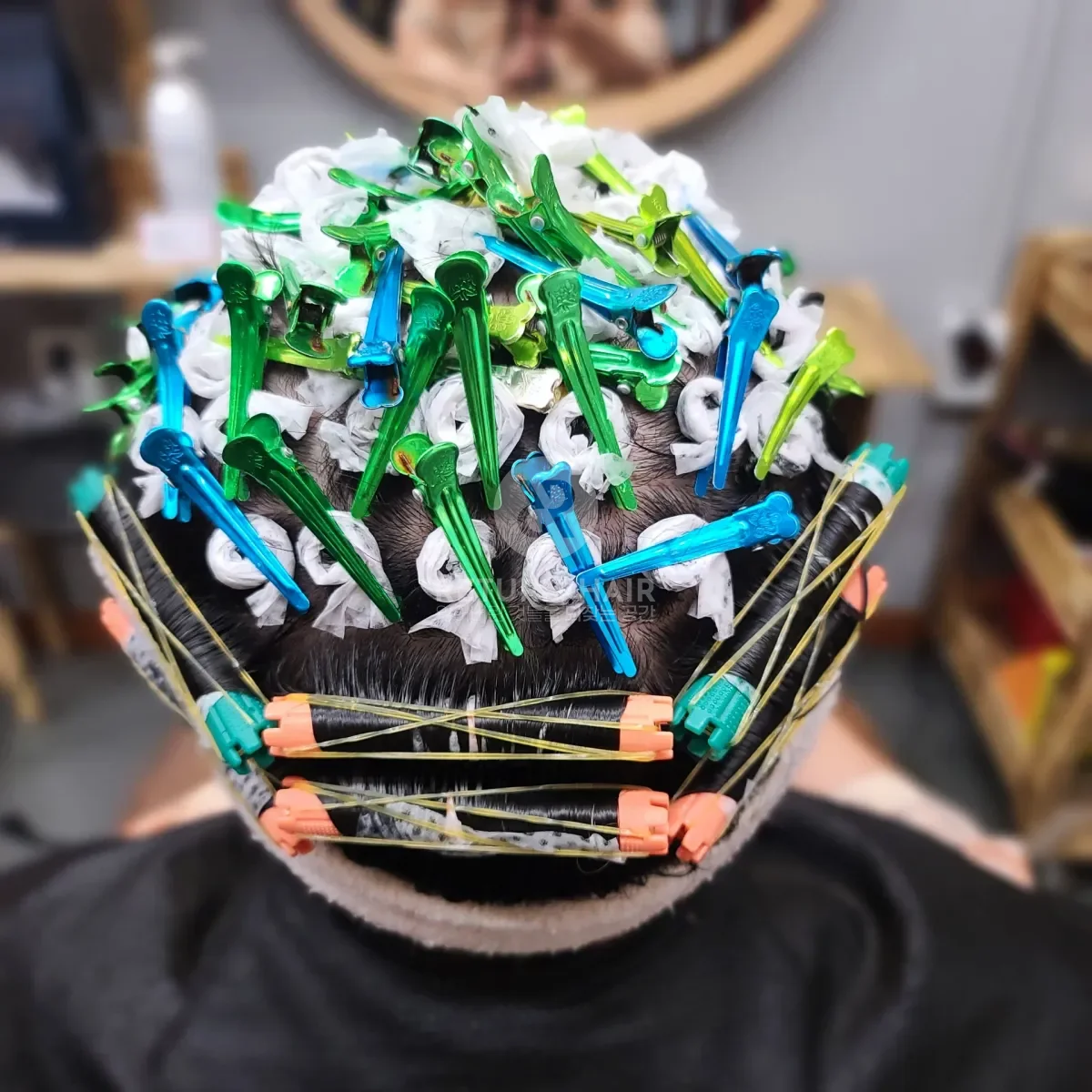 탈모 치트펌 파마 시술 전 사진 4