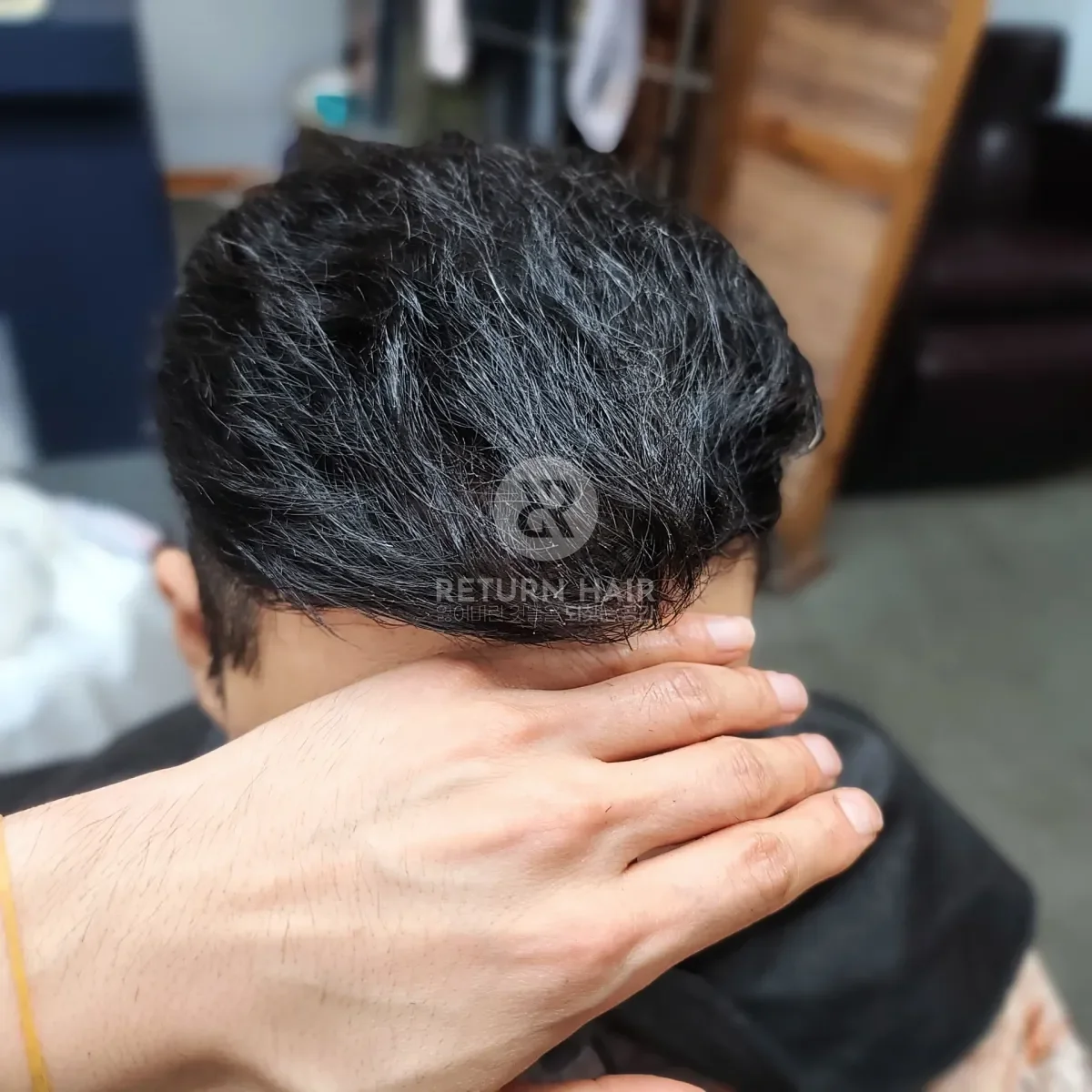 탈모 치트펌 파마 시술 후 결과 사진