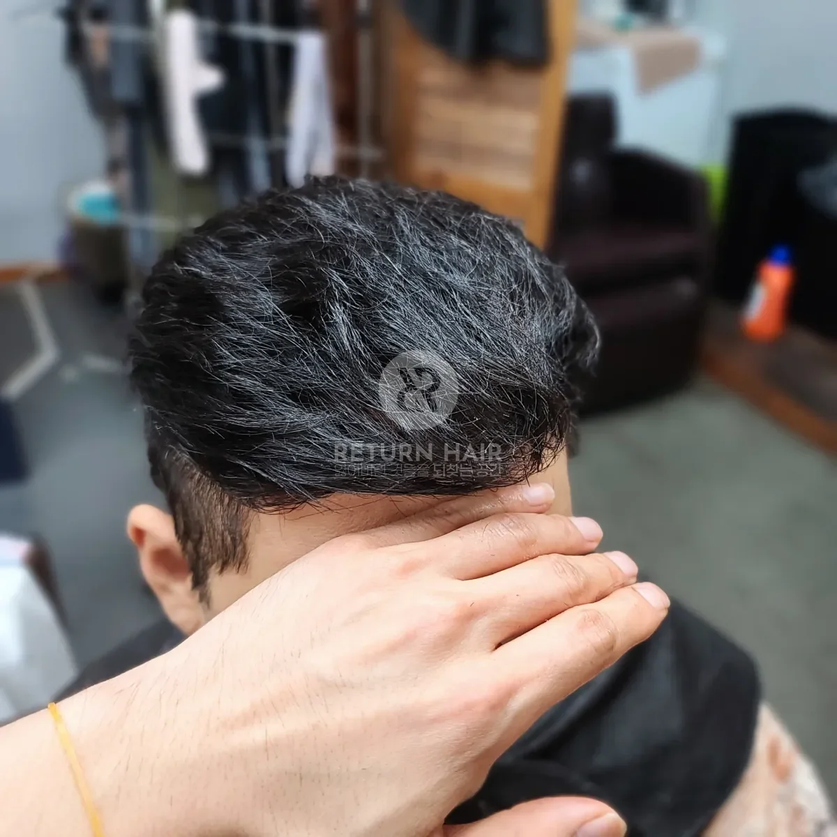 탈모 치트펌 파마 시술 후 결과 사진 5