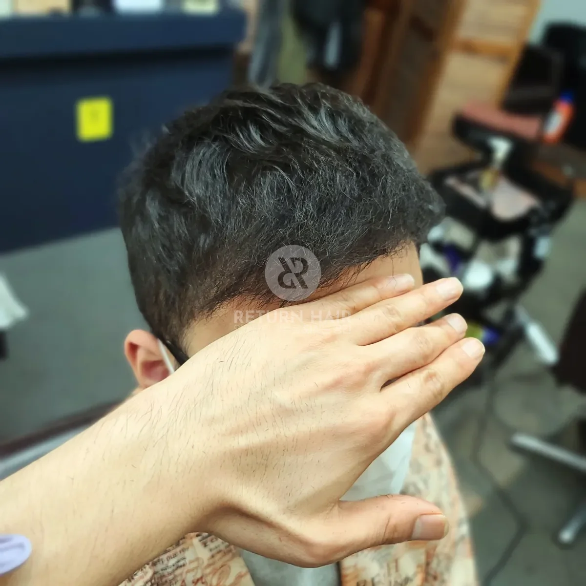 탈모 치트펌 파마 시술 후 결과 사진 5