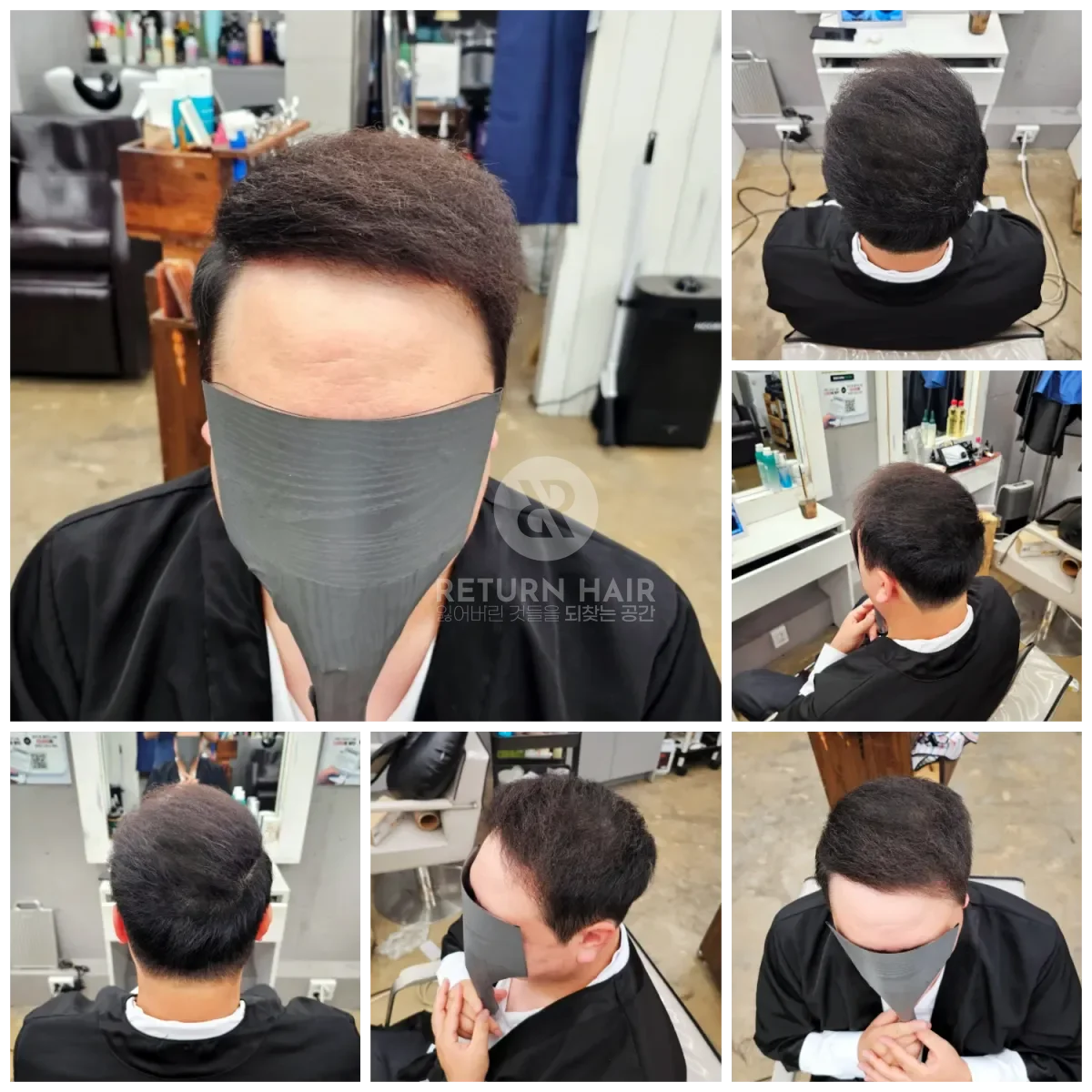 탈모 치트펌 파마 시술 후 결과 사진
