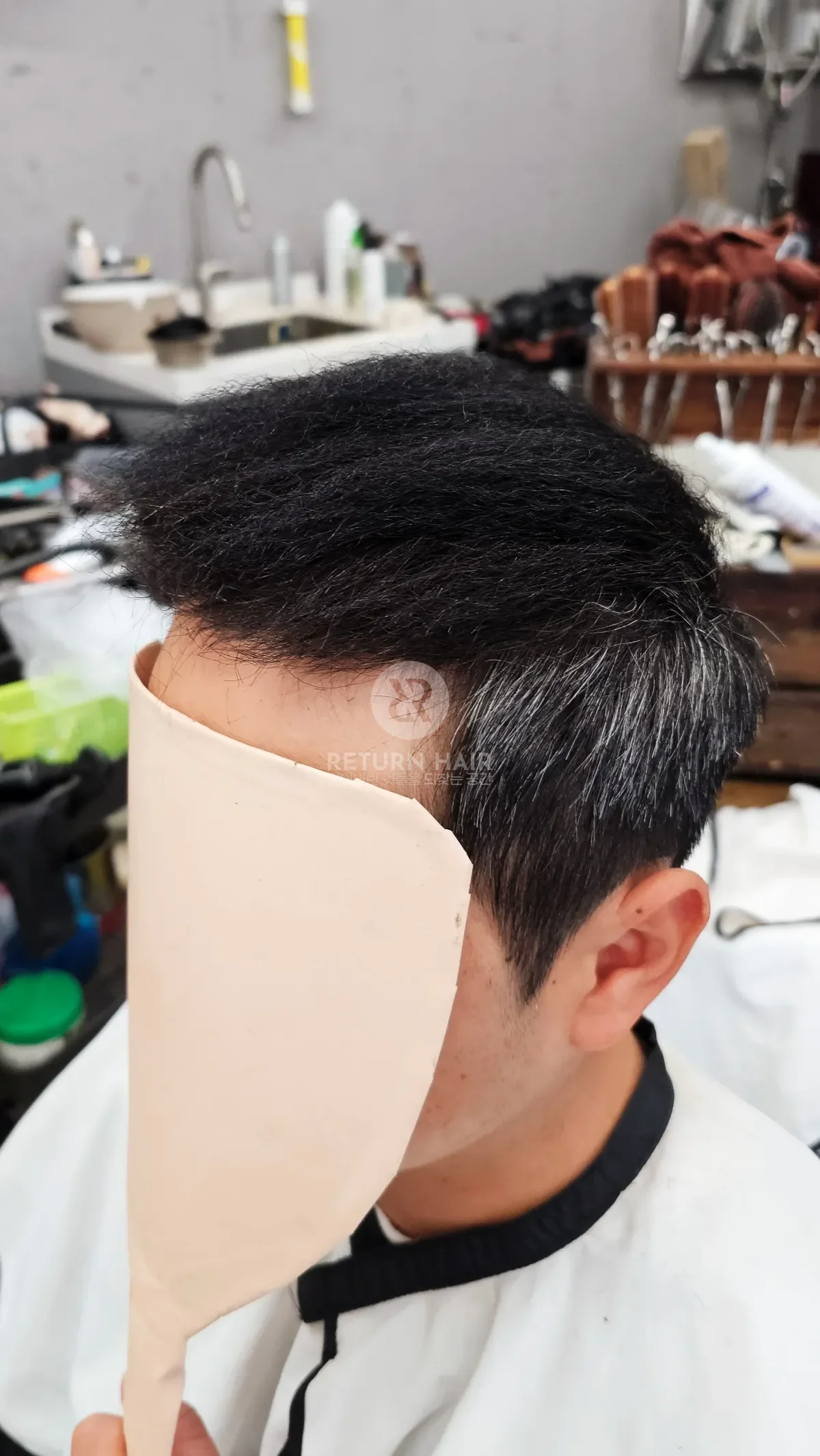 탈모 치트펌 파마 시술 후 결과 사진 4
