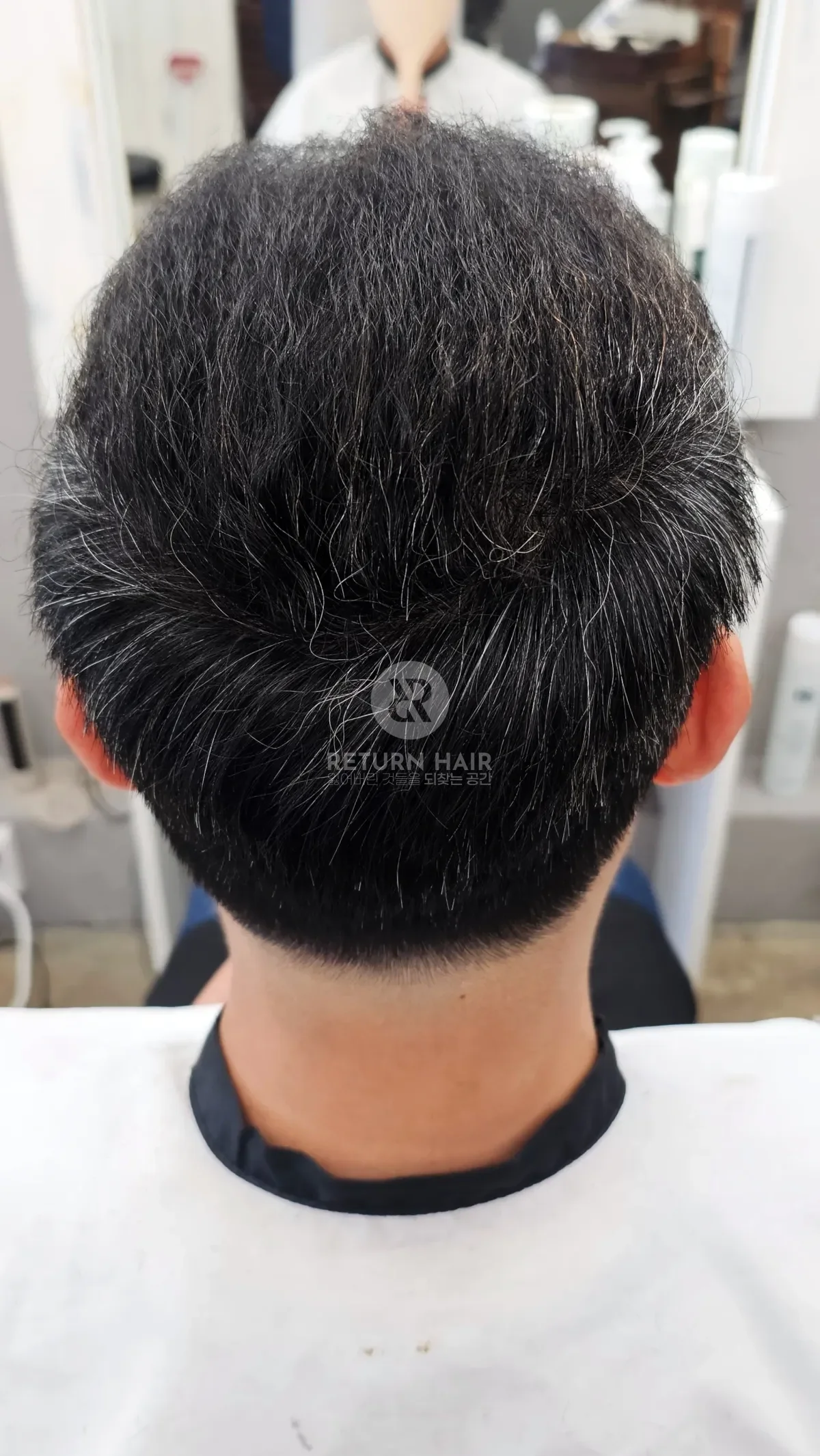 탈모 치트펌 파마 시술 후 결과 사진 6