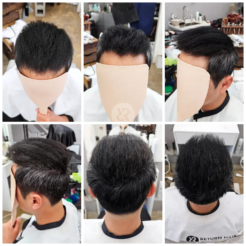 탈모 치트펌 파마 시술 후 결과 사진