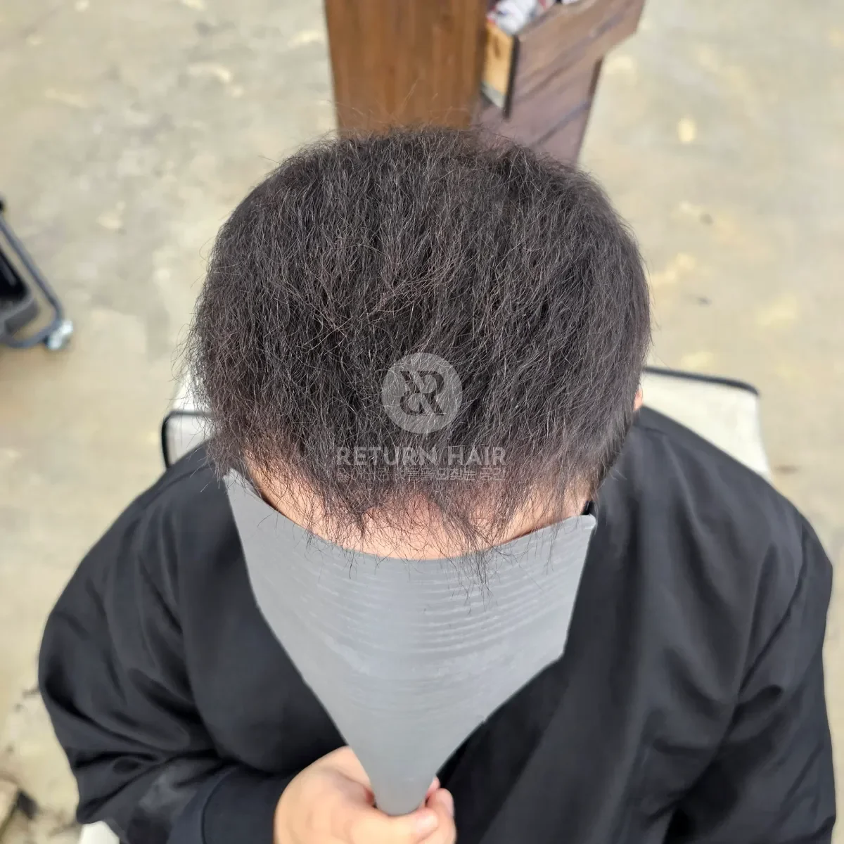 탈모 치트펌 파마 시술 후 결과 사진