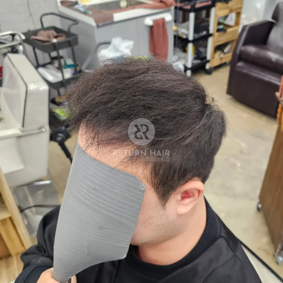 탈모 치트펌 파마 시술 후 결과 사진 4