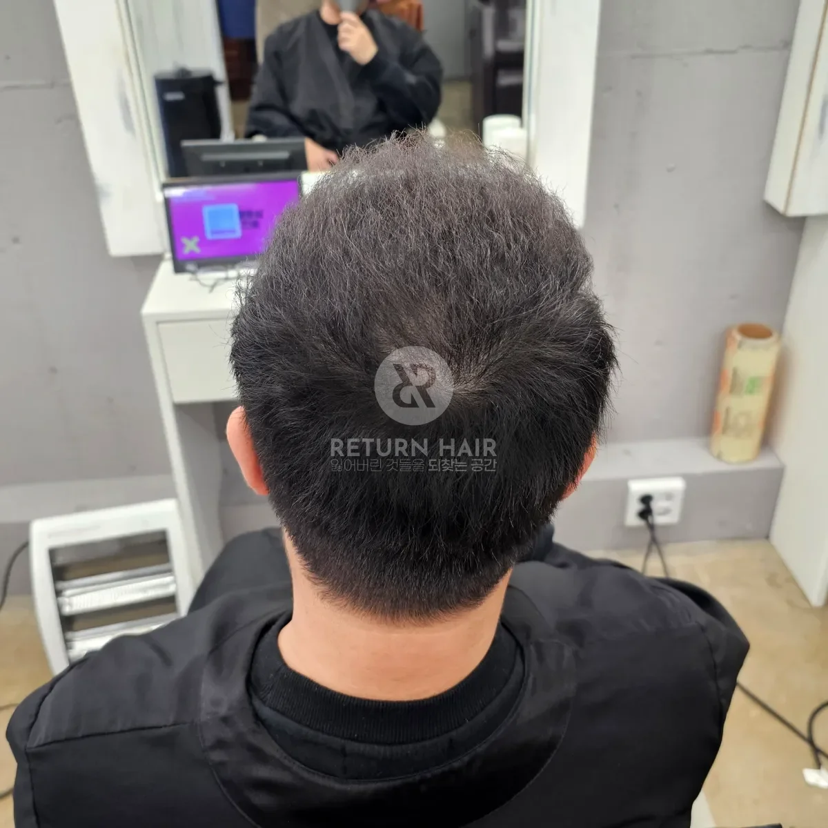 탈모 치트펌 파마 시술 후 결과 사진 6