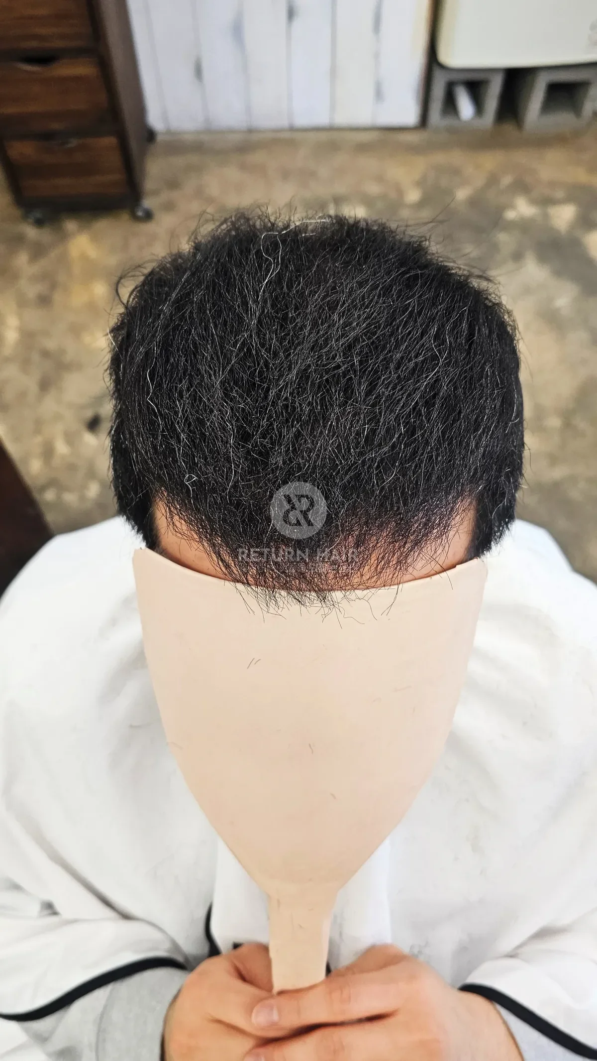탈모 치트펌 파마 시술 후 결과 사진
