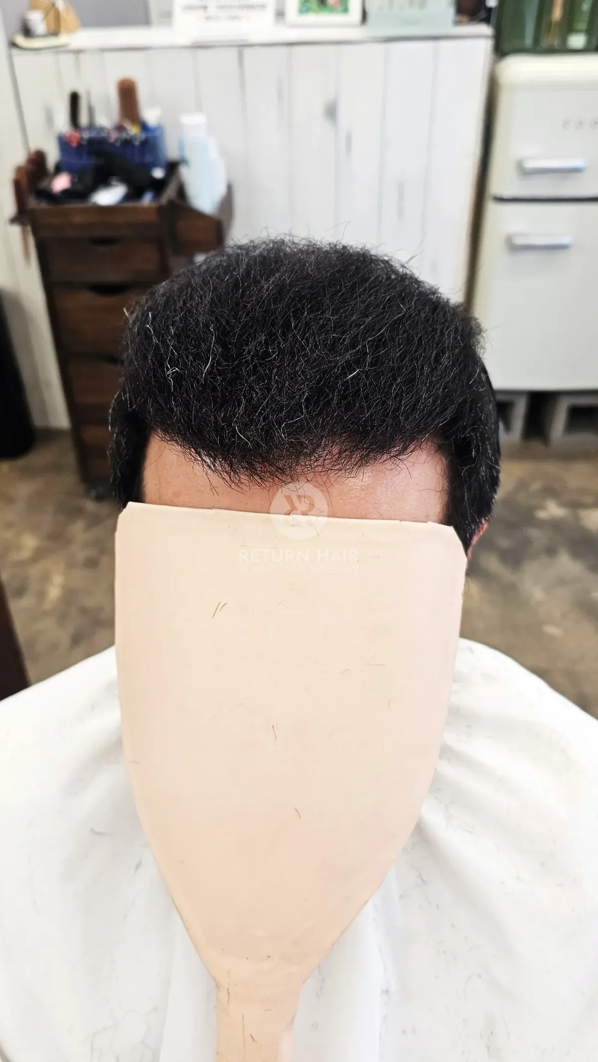 탈모 치트펌 파마 시술 후 결과 사진 2