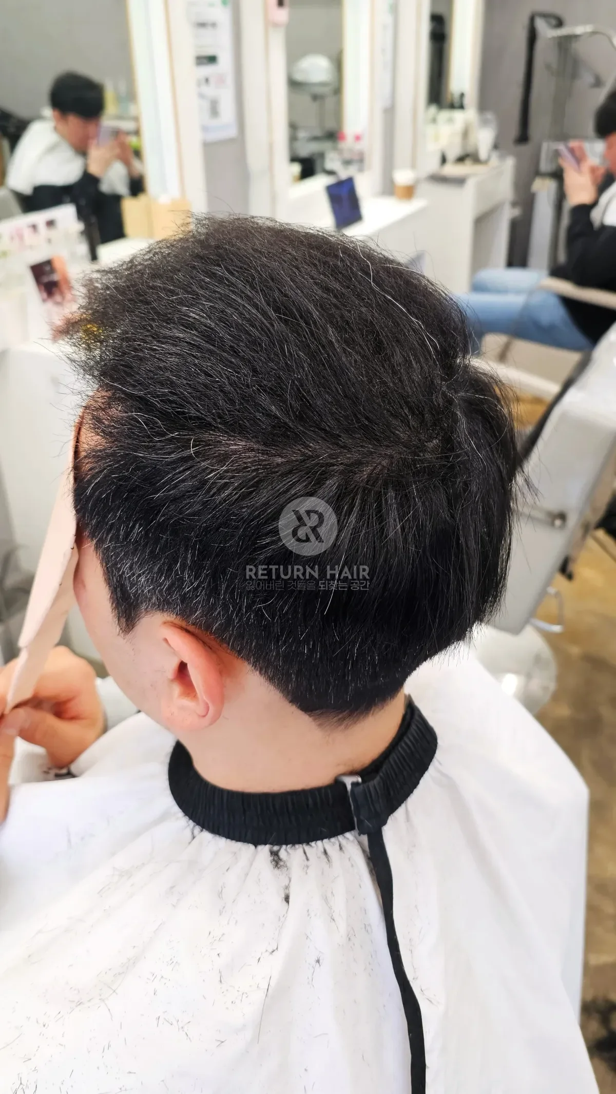 탈모 치트펌 파마 시술 후 결과 사진 4