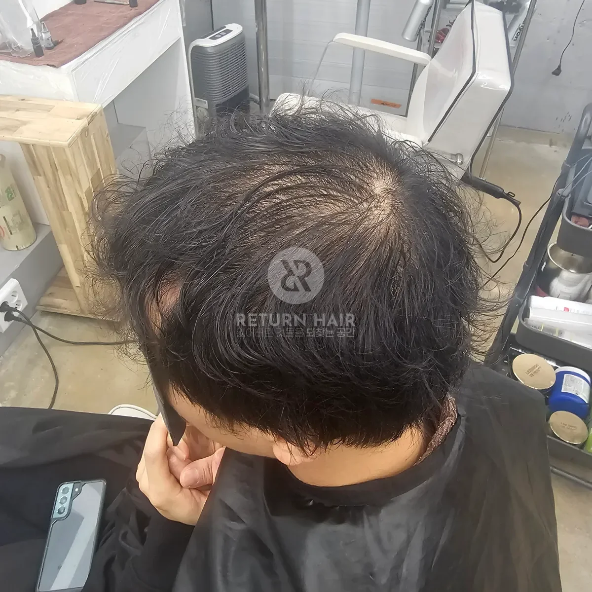 두피페인팅 (치트염색) 시술 전 사진 4