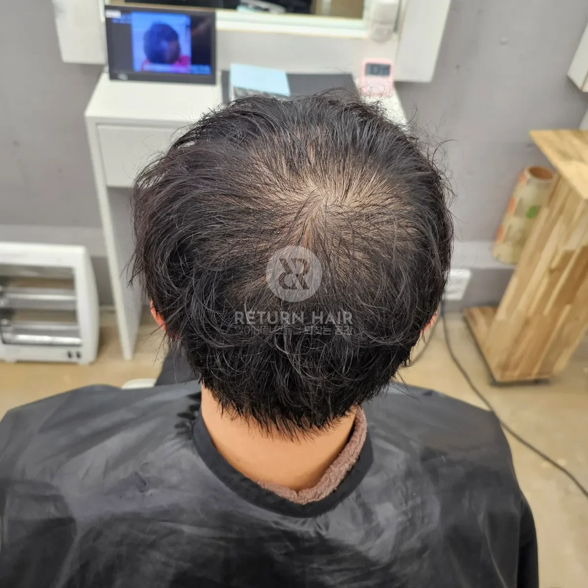 두피페인팅 (치트염색) 시술 전 사진 5