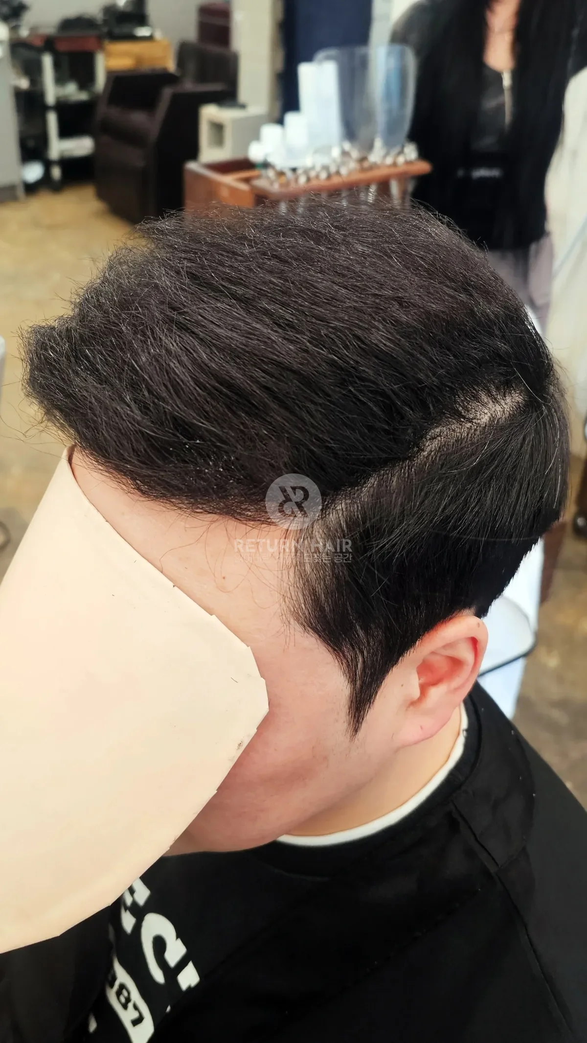 탈모 치트펌 파마 시술 후 결과 사진 3