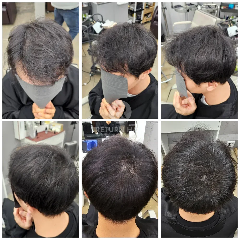 두피페인팅 (치트염색) 시술 후 결과 사진