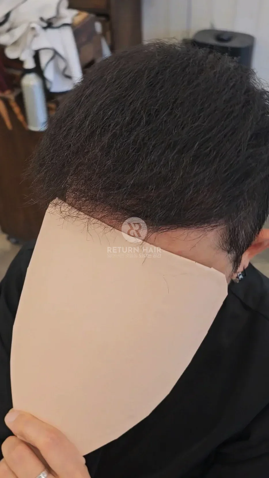 탈모 치트펌 파마 시술 후 결과 사진