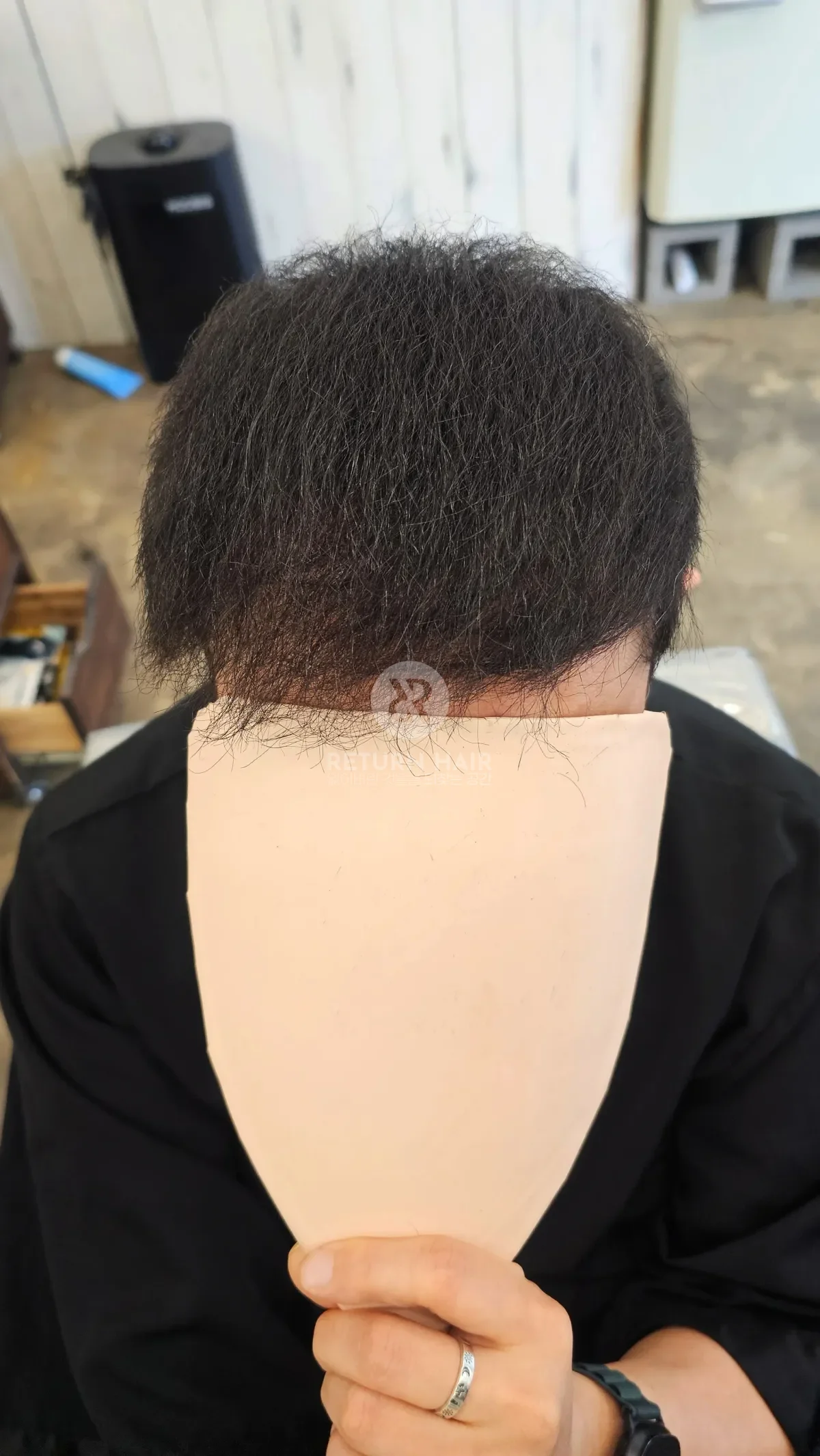 탈모 치트펌 파마 시술 후 결과 사진 2