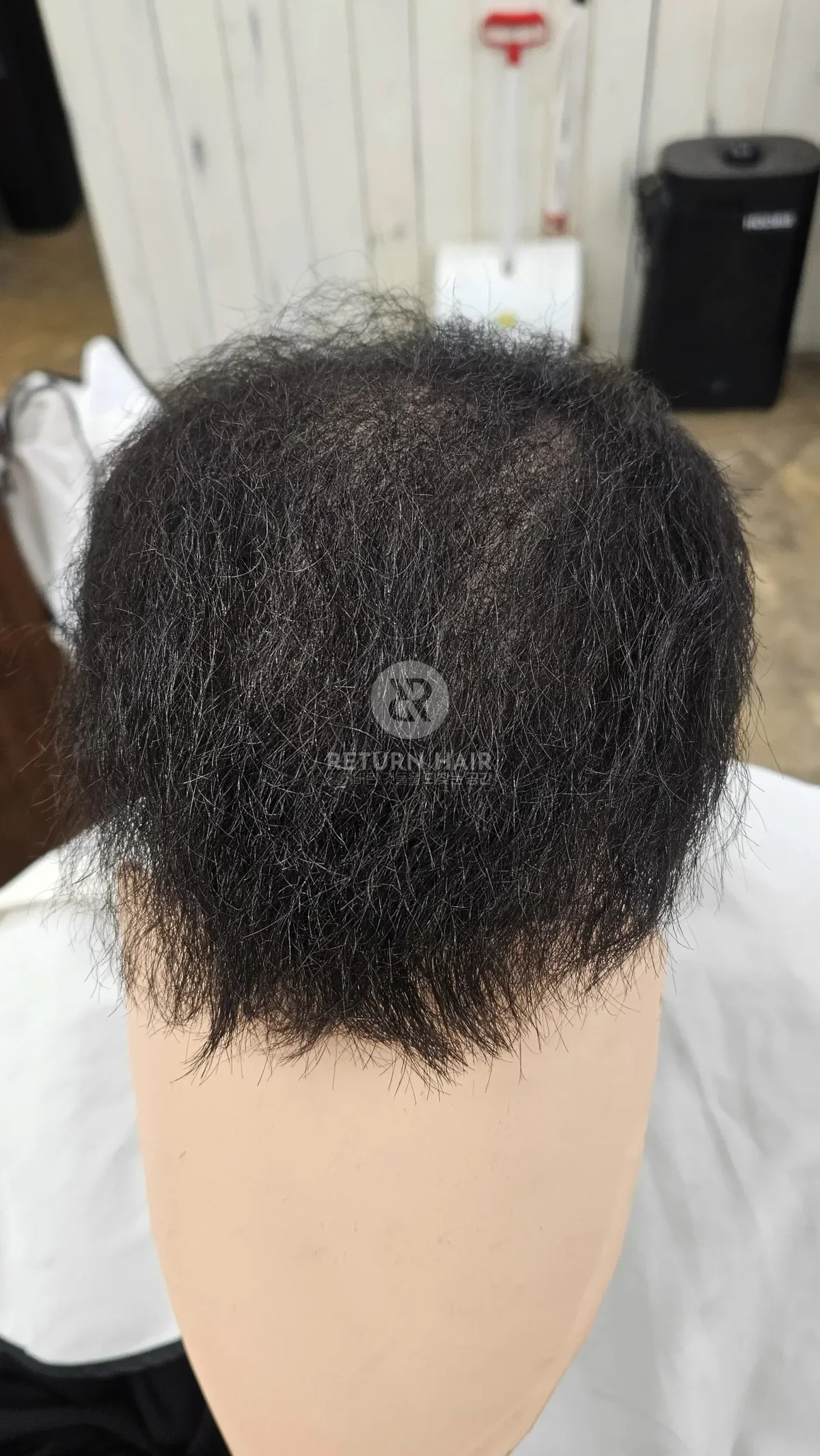 탈모 치트펌 파마 시술 후 결과 사진