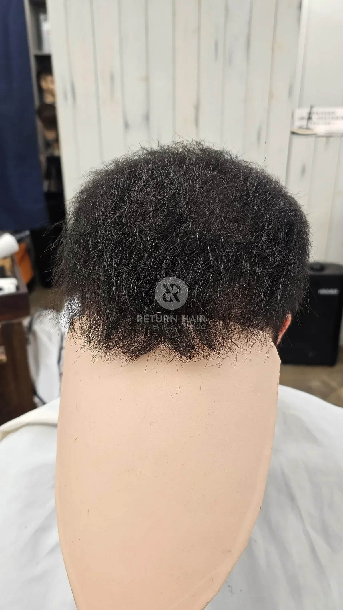 탈모 치트펌 파마 시술 후 결과 사진 2