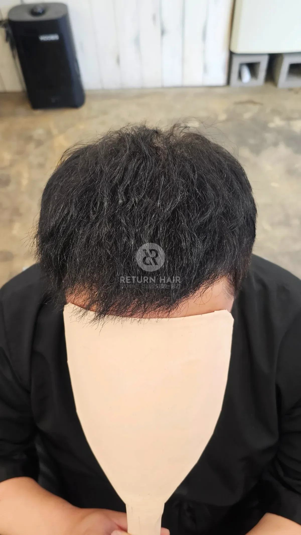 탈모 치트펌 파마 시술 후 결과 사진