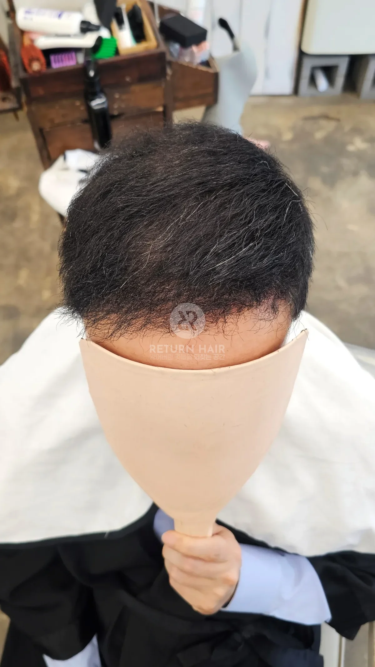 탈모 치트펌 파마 시술 후 결과 사진