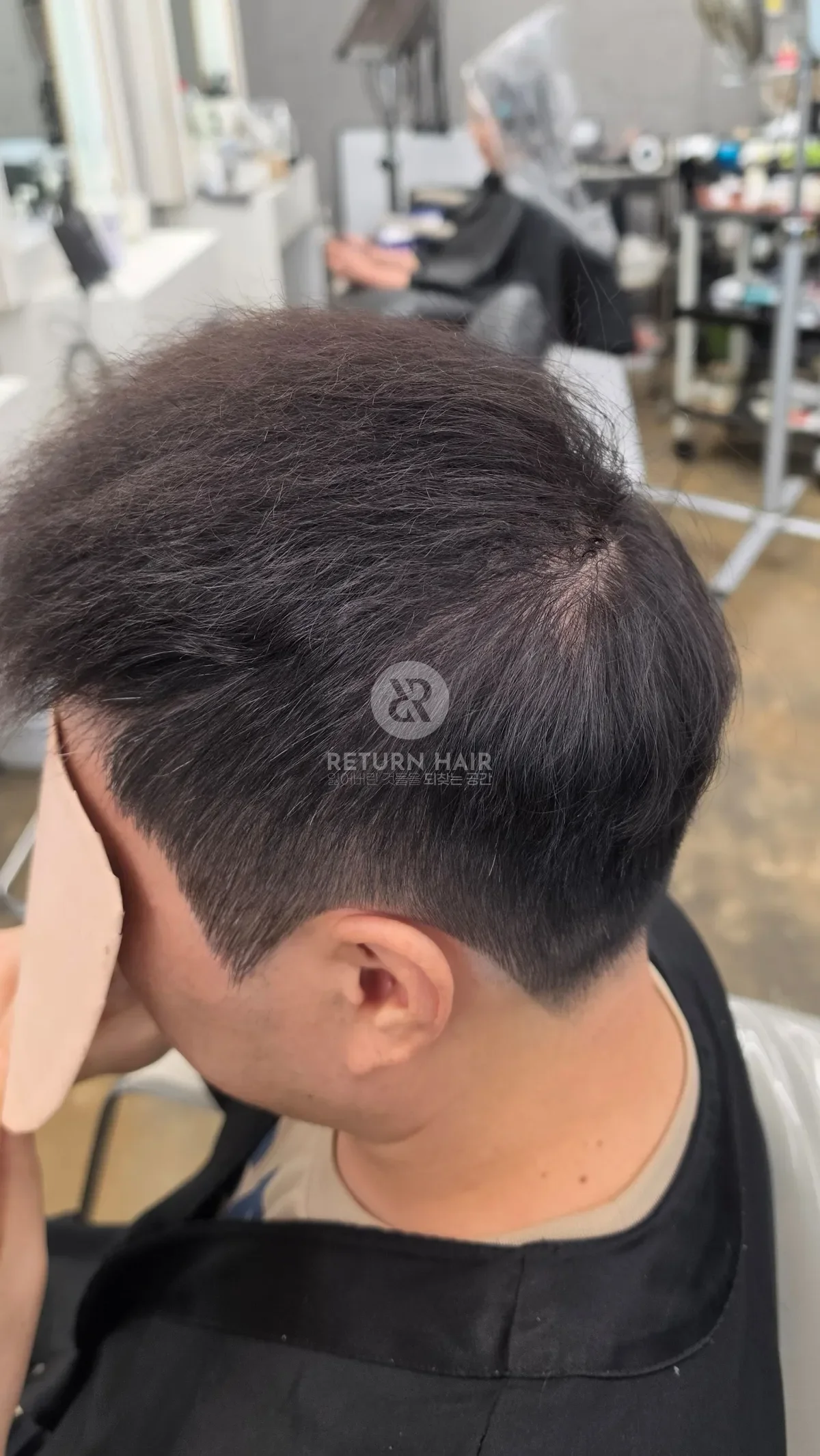 탈모 치트펌 파마 시술 후 결과 사진 3