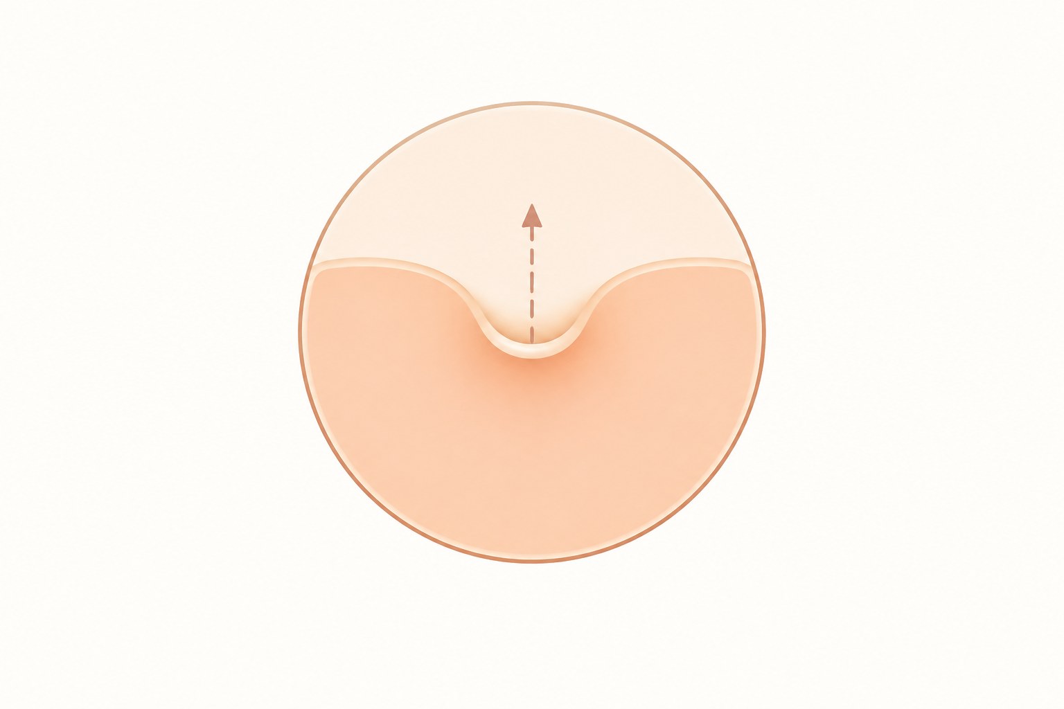 유두 양쪽 작은 절개