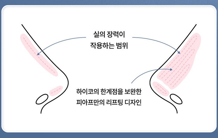 하이코의 한계점을 보완한 피아프 리프팅 디자인 — 실의 장력이 작용하는 범위 도해
