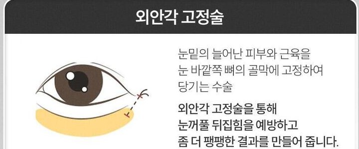 외안각 고정술 - 눈밑의 늘어난 피부와 근육을 눈 바깥쪽 뼈의 골막에 고정하여 당기는 수술